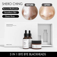 Load image into Gallery viewer, SHERO CHING - BYE BYE BLACKHEADS SET
