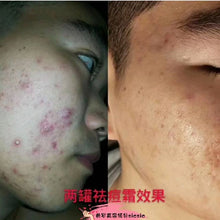 Load image into Gallery viewer, SHERO CHING - HARMONY CREAM (PIMPLE CREAM)
